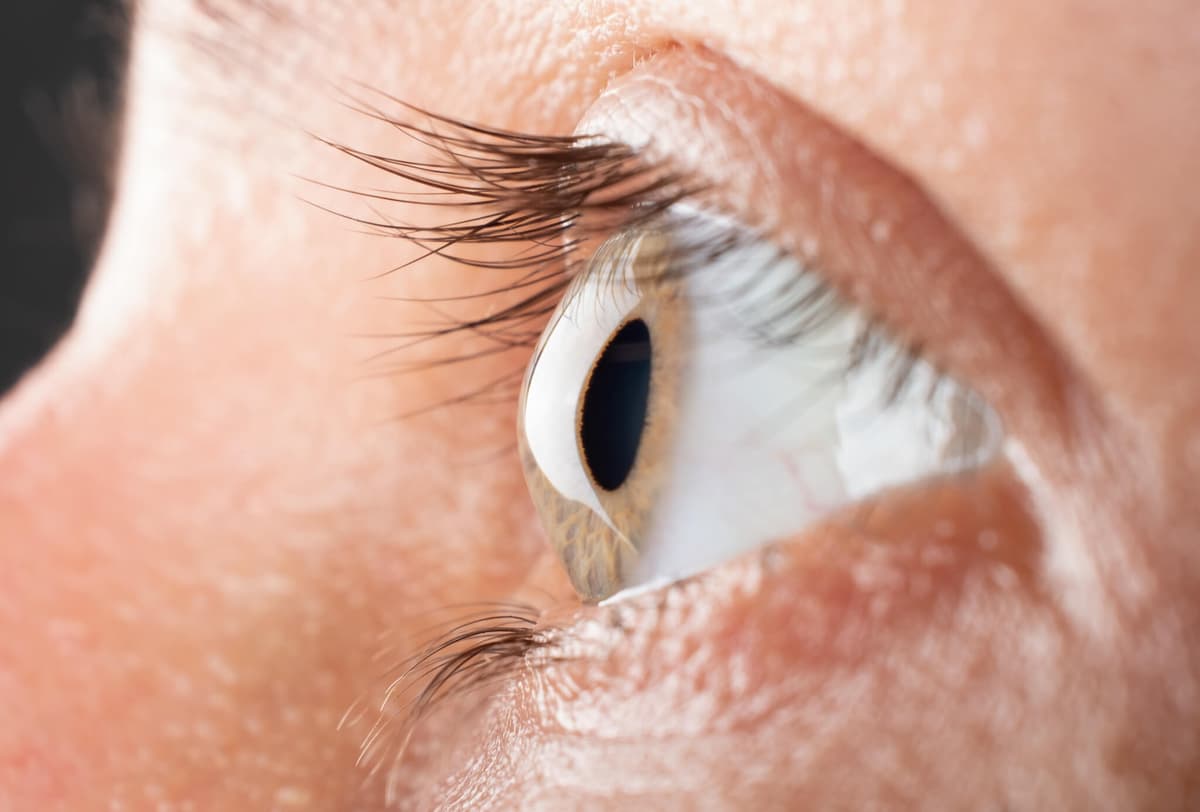 Corneal Disease Treatment